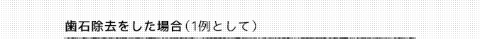 歯石除去をした場合（1例として）