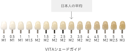 VITAシェードガイド