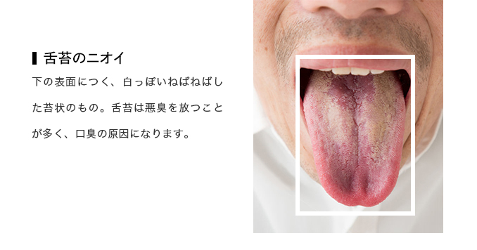 ・舌苔のニオイ
下の表面につく、白っぽいねばねばした苔状のもの。舌苔は悪臭を放つことが多く、口臭の原因になります。