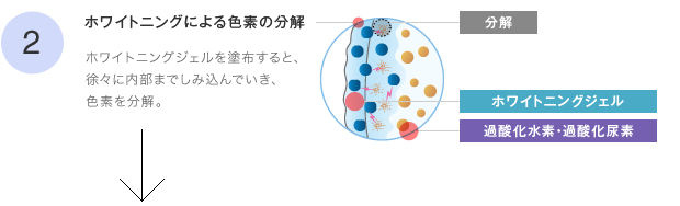 2ホワイトニングによる色素の分解